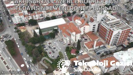 Akhisar’da Lazerle Böbrek Taşı Tedavisinde Yeni Dönem Başladı