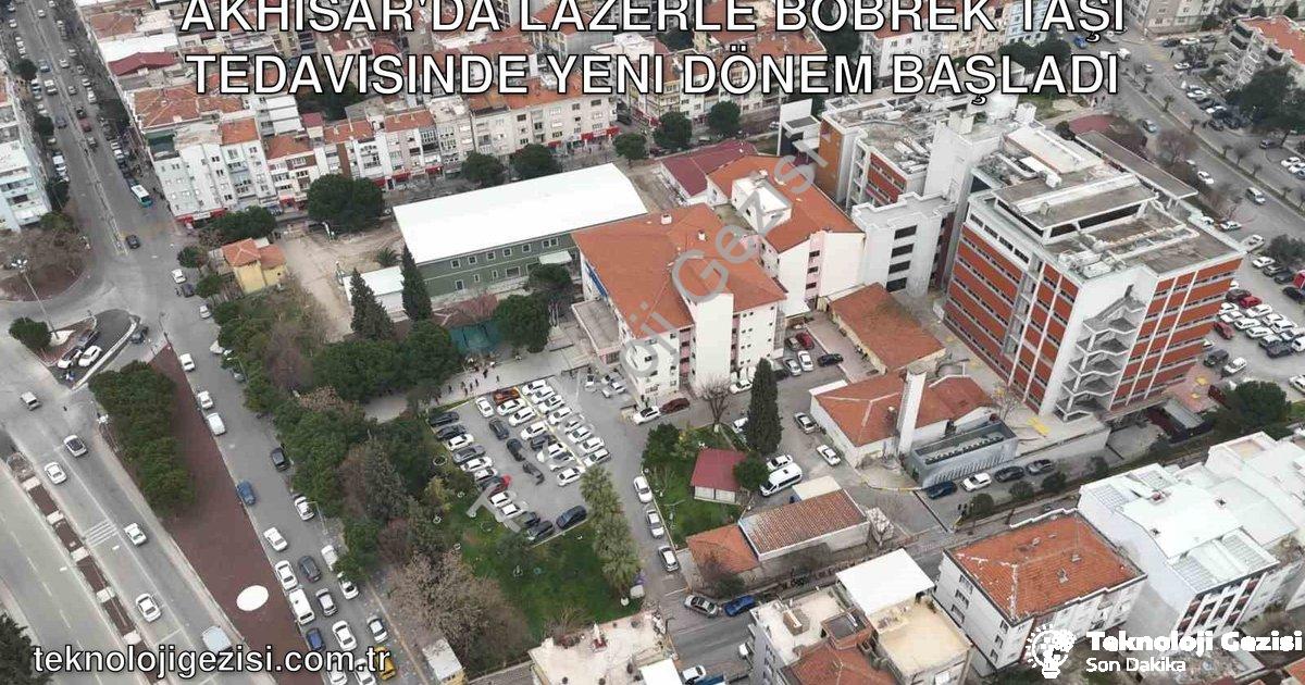 "Akhisar'da Lazerle Böbrek Taşı Tedavisinde Yeni Dönem Başladı" başlıklı haber için fotorealistik, p